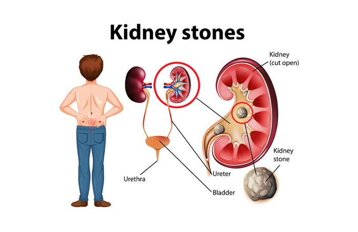 CBD et insuffisance rénale : tout ce qu’il faut savoir